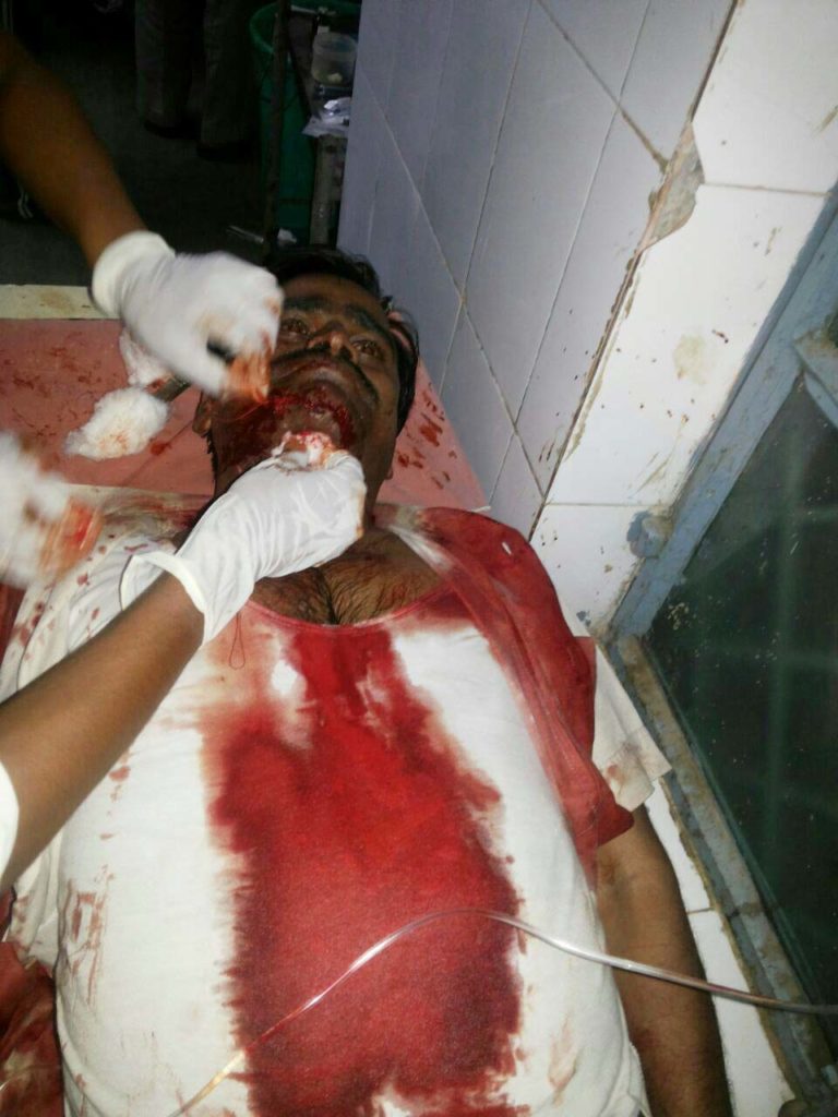 घटना के बाद अस्पताल में भर्ती गंभीर रूप से घायल नरेंद्र यादव का फाइल फोटो।